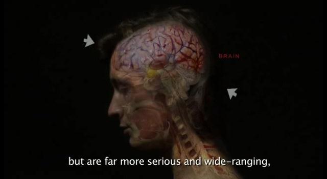 Кадр из фильма Синдром Гербера: Заражение / The Gerber Syndrome: il contagio (2011)
