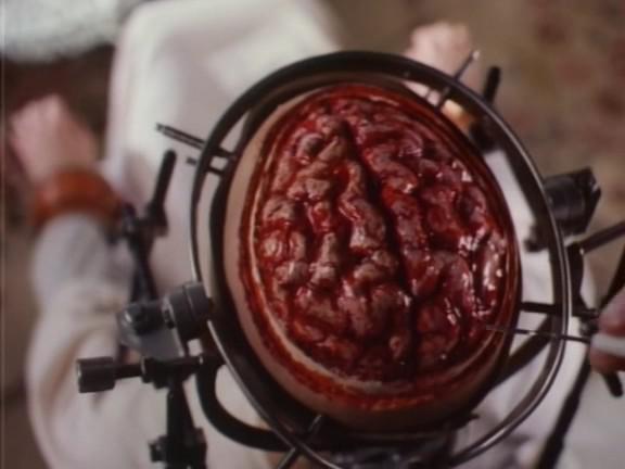Кадр из фильма Мертвый мозг (Когда умирает мозг) / Brain Dead (1990)